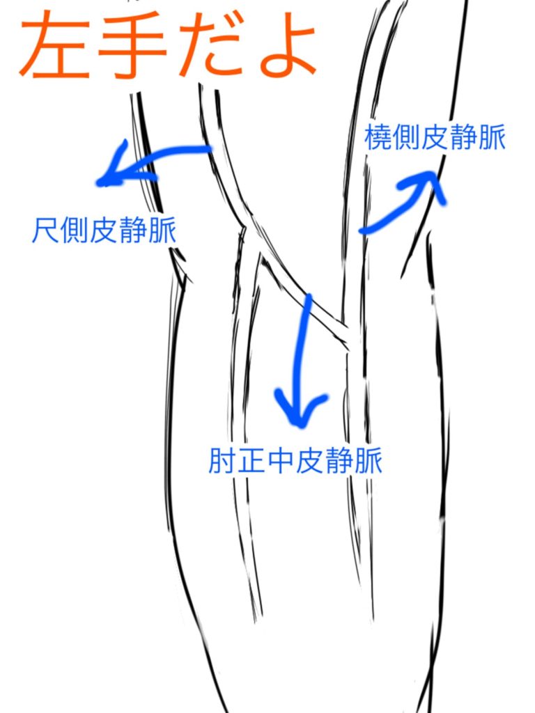 【保存版】採血できない看護師なくす11の手順を徹底解説【あるあると練習方法】