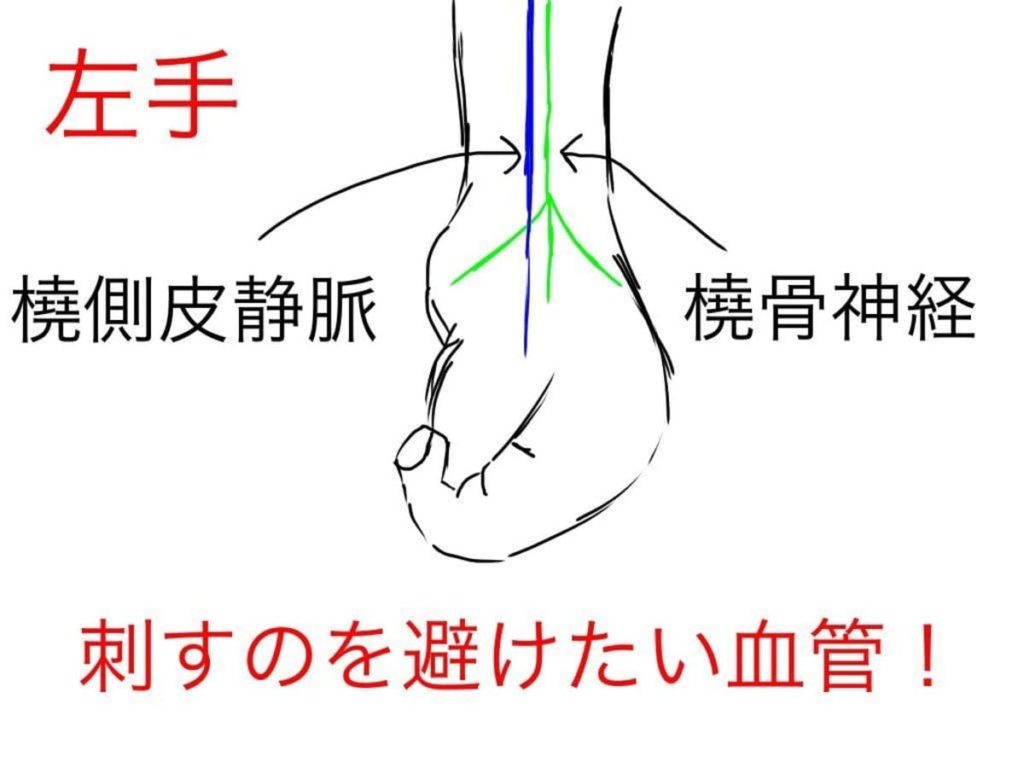 【失敗しない】点滴下手な看護師が93.5成功する点滴10つの手順 【失敗しない】点滴下手な看護師が93.5成功する点滴10つの手順
