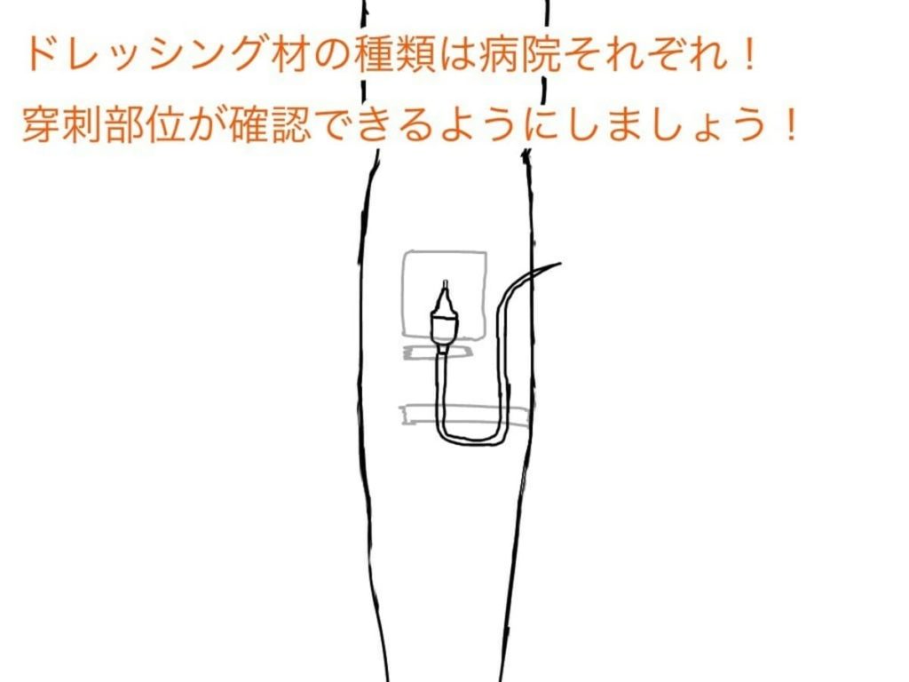 【失敗しない】点滴下手な看護師が93.5%成功する点滴10つの手順